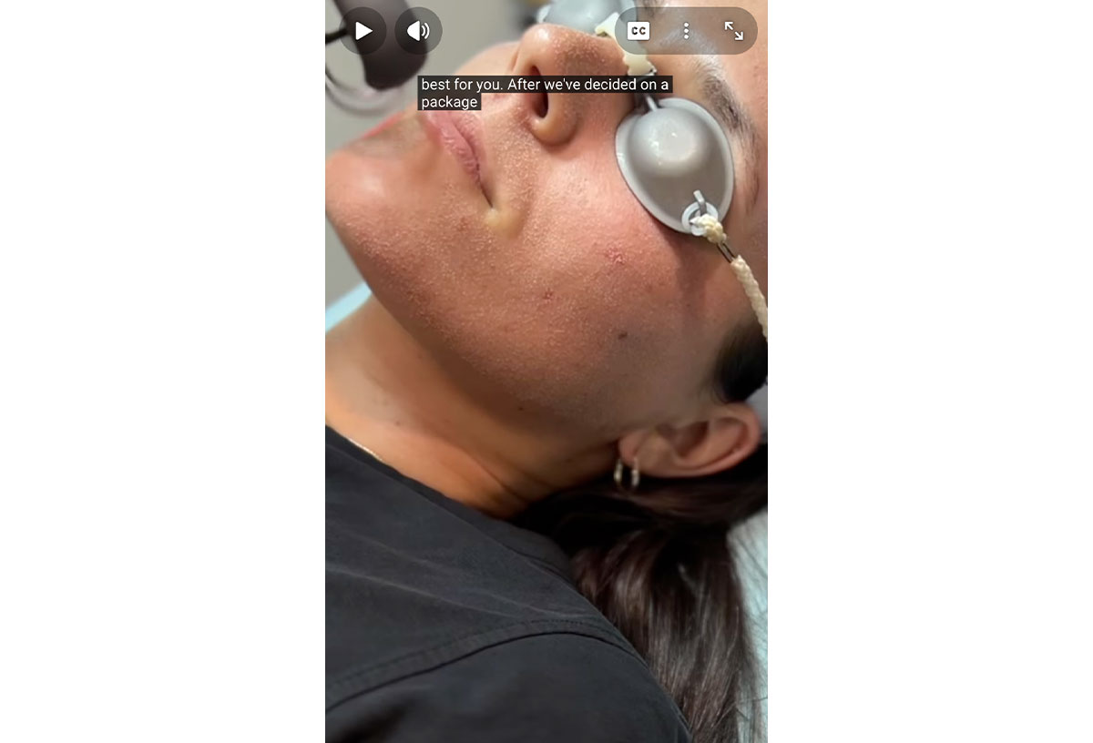 video preview